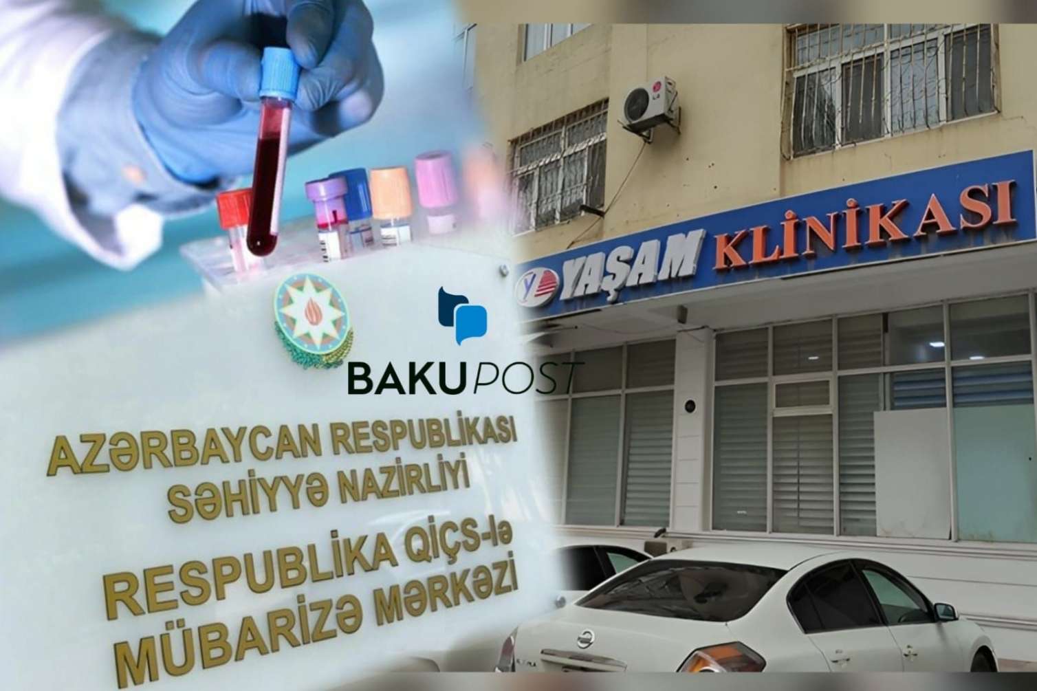 Bakıda dəhşət: "Yaşam"ın analizindən sağlam çıxan qadın QİÇS xəstəsi imiş -